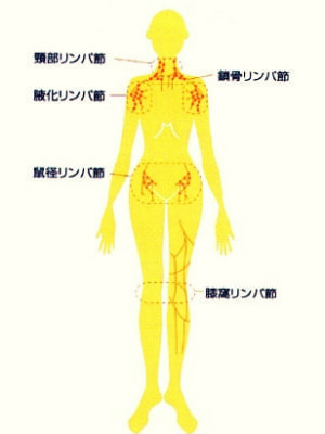 デトックス